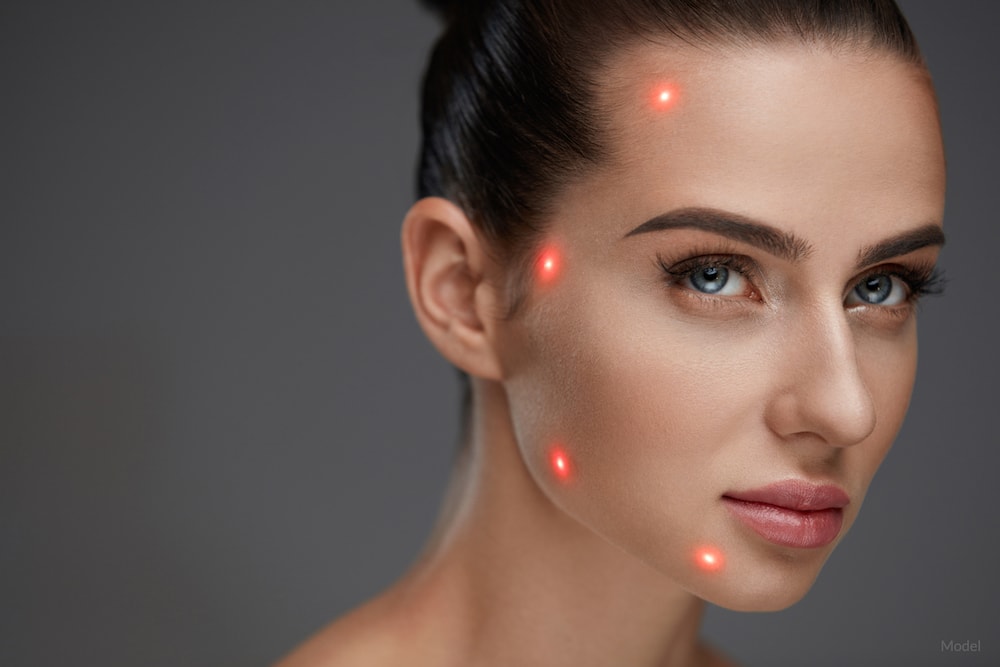 During a Smartlipo® procedure, laser energy is used to liquefy fat in the face and tighten surrounding tissue.